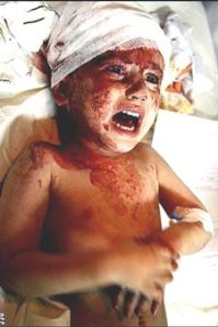 gaza_bombing_victim