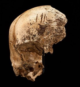 Four shallow chop marks on the top of the girl’s skull, evidence of cannibalism during the “starving time” over the winter of 1609-1610. (Smithsonian Institution / Don Hurlbert)