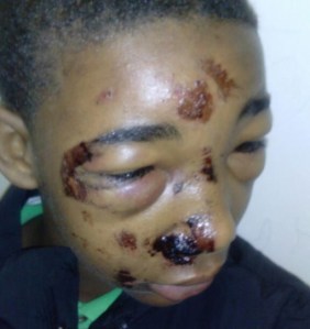 teen+police+brutality+2