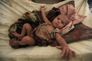 A Muslim child lies in a hammock at a refugee camp outside of Sittwe