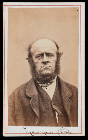 L0041119 'Monomania of pride' patient at West Riding Lunatic Asylum