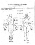 Drawing from autopsy of Laquan&nbsp;McDonald